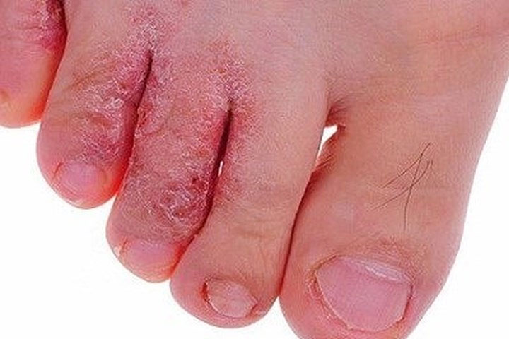 nuoc-an-chan Nước ăn chân