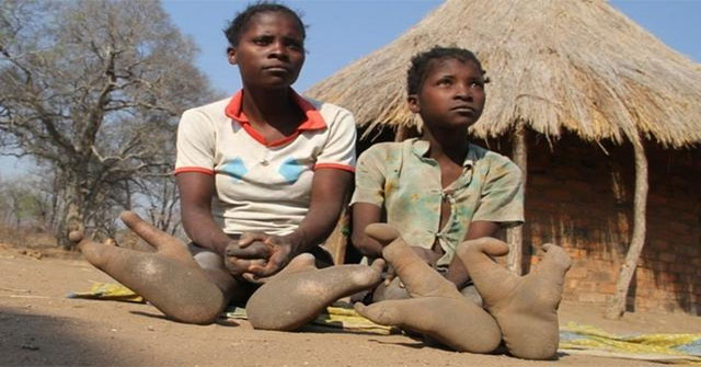 Khám Phá Bộ Lạc Vadoma: Những Bí Ẩn Về Chân Đà Điểu Tại Châu Phi
