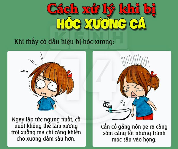 Giải pháp cho khi bị hóc xương cá