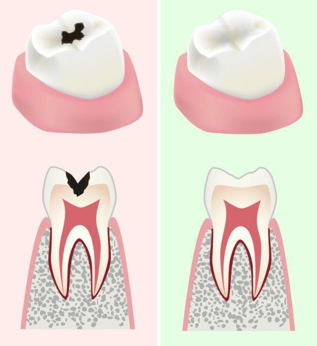 Tăng cường sức khỏe răng miệng