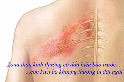 Vết thương do kiến ba khoang gây ra thường xuất hiện đột ngột Vết thương do kiến ba khoang gây ra thường xuất hiện đột ngột