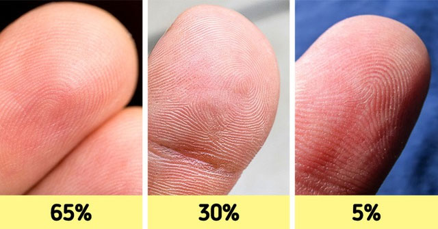 Khám Phá 12 Đặc Điểm Cơ Thể Hiếm Gặp: Điều Gì Làm Bạn Khác Biệt?